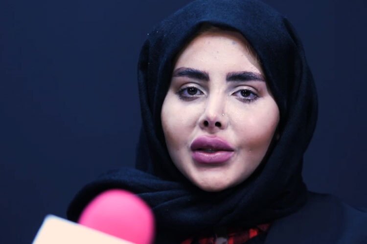 اولین مصاحبه سحر تبر پس از آزادی از زندان و افشای چهره واقعی او اولین مصاحبه سحر تبر پس از آزادی از زندان و افشای چهره واقعی او