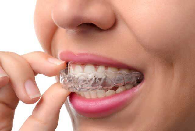 بهترین سن ارتودنسی /چگونه بفهمیم به ارتودنسی نیاز داریم؟