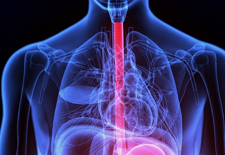 ترک مصرف الکل برای پیشگیری از رفلاکس معده پیشگیری از رفلاکس معده, راههای پیشگیری از رفلاکس معده, رفلاکس معده