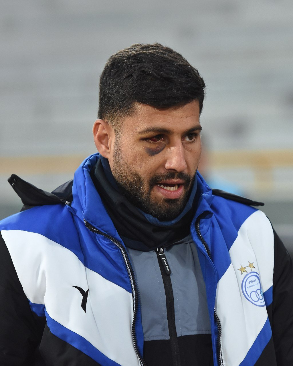 عکس| وضعیت ترسناک مصدومیت چشم مدافع استقلال