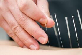 طب سوزنی، ابزاری موثر در برابر درد