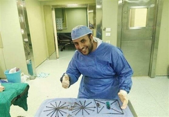 خارج شدن ۳۹ میخ فندک و قیچی از معده یک بیمار