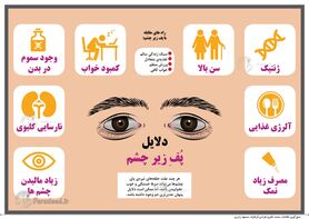 اینفوگرافی: دلایل پف زیر چشم