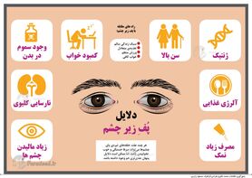 اینفوگرافی: دلایل پف زیر چشم