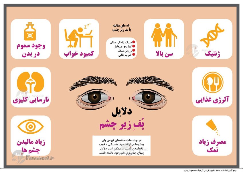 اینفوگرافی: دلایل پف زیر چشم