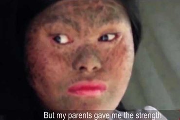 دختری معروف به بانوی مار!