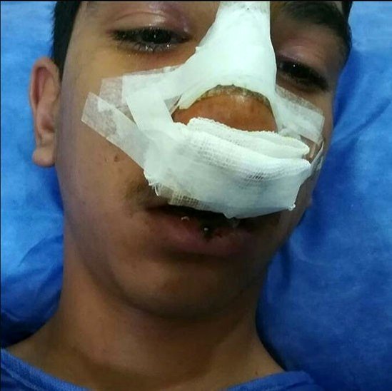 کتک خوردن دانش آموز جیرفتی از مدیر مدرسه