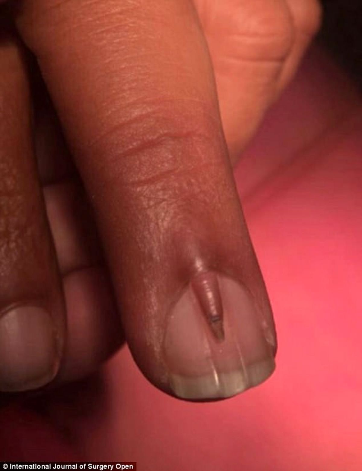 مردی با ناخن های دو طبقه!