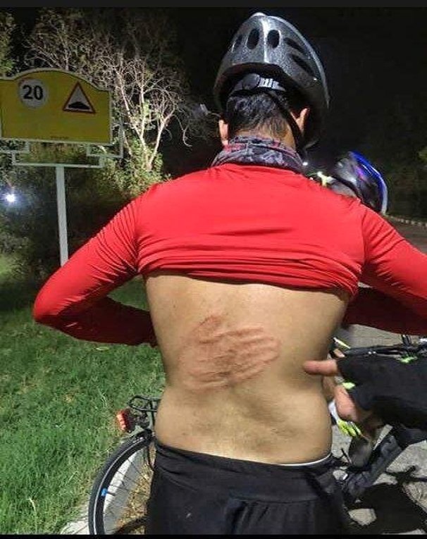 روایتی از آزار و اذیت غیر قابل باور یک دوچرخه‌سوار! + عکس