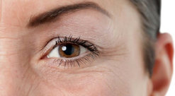  عوارض تزریق بوتاکس دور چشم