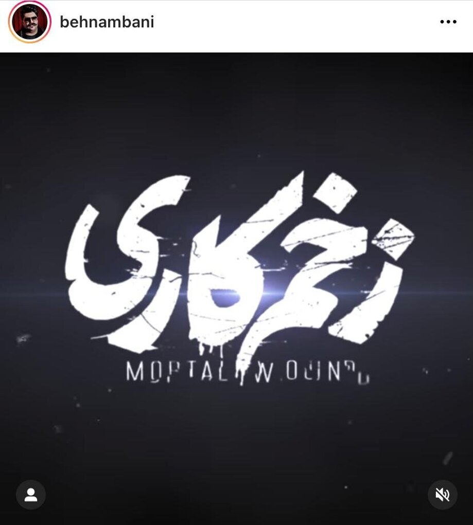 آهنگ «زخم کاری» منتشر شد