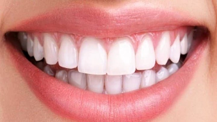 درباره ناهنجارهای دندانی چه می دانید؟