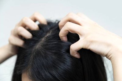 شوره سر چیست و چگونه به وجود می آید ؟