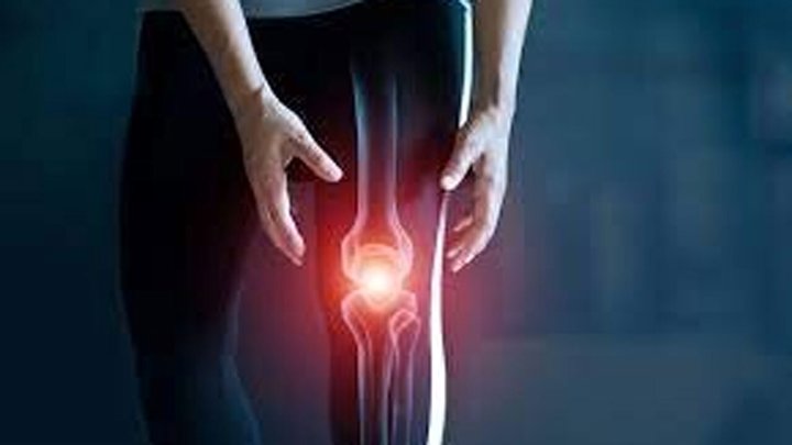 علل ابتلا و راه‌های درمان آرتروز زانو + فیلم