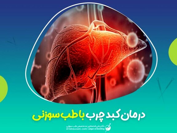درمان کبد چرب  با طب سوزنی