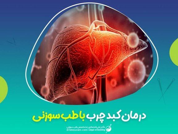 درمان کبد چرب  با طب سوزنی