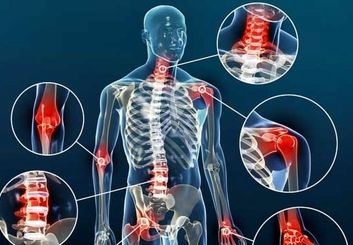 آرتروز چیست؟ | علائم، علل، درمان و روش‌های پیشگیری