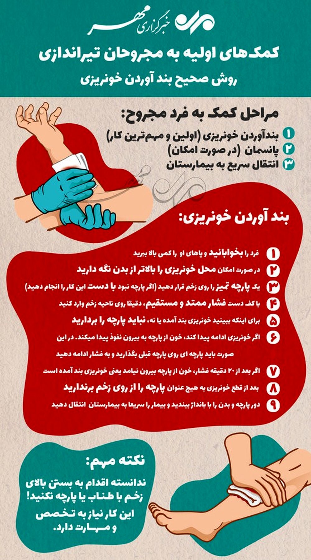 کمک‌های اولیه به مجروحان تیراندازی/روش صحیح بند آوردن خونریزی