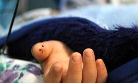 بخاری بدون دودکش بلای جان دختر 11ساله شد